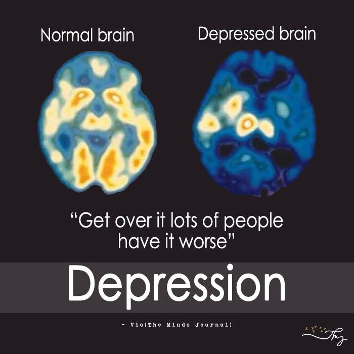 Normal Brain V/s Depressed Brain