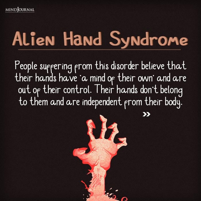 alien hand syndrome